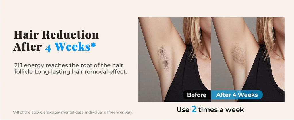 Updated IPL Hair Removal Laser Device 999900+ Flashes 21J Auto/Manual Mode for Men Women Facial Body Bikini  in 4 Weeks Home Use