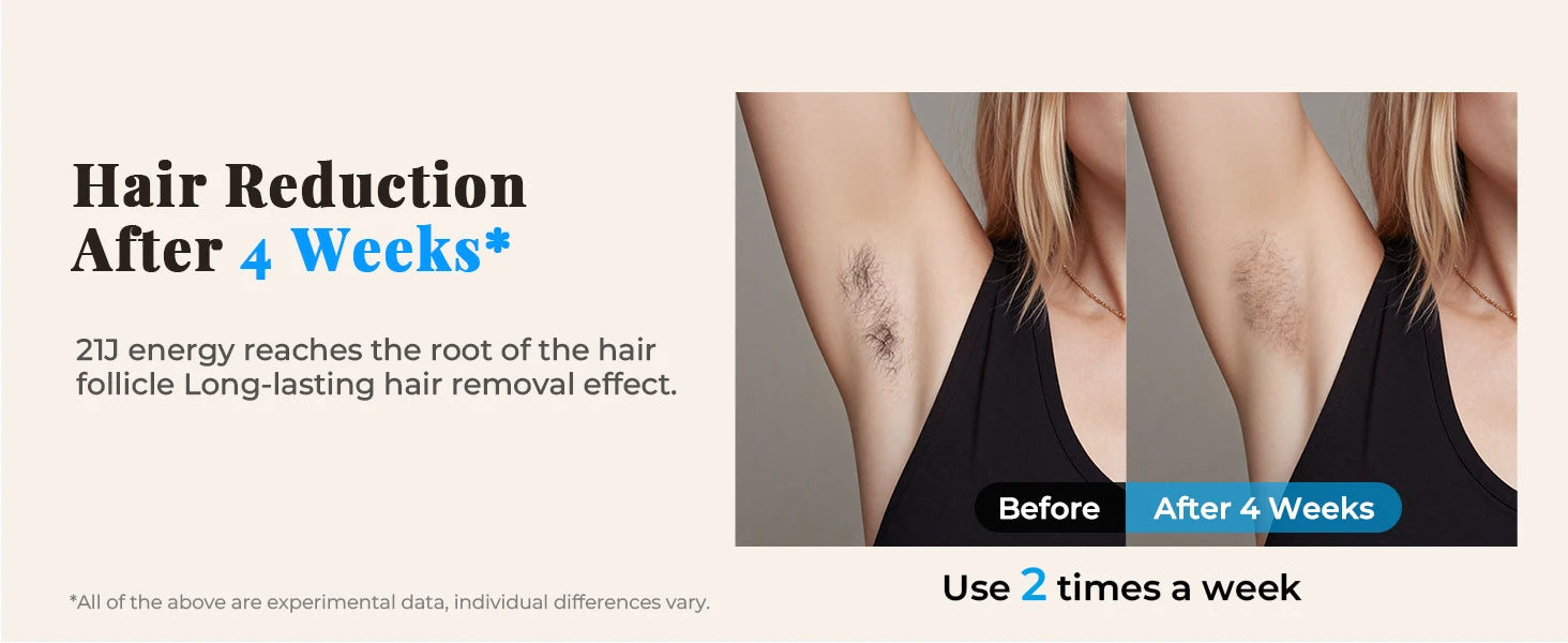 Updated IPL Hair Removal Laser Device 999900+ Flashes 21J Auto/Manual Mode for Men Women Facial Body Bikini  in 4 Weeks Home Use