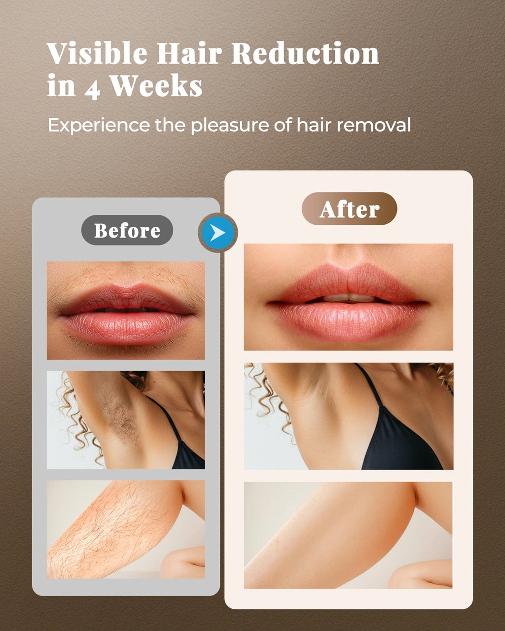 Updated IPL Hair Removal Laser Device 999900+ Flashes 21J Auto/Manual Mode for Men Women Facial Body Bikini  in 4 Weeks Home Use