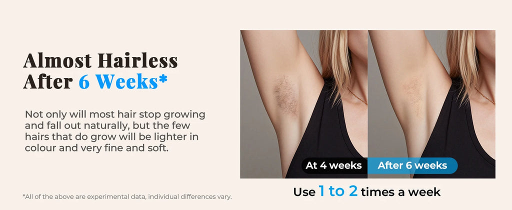 Updated IPL Hair Removal Laser Device 999900+ Flashes 21J Auto/Manual Mode for Men Women Facial Body Bikini  in 4 Weeks Home Use