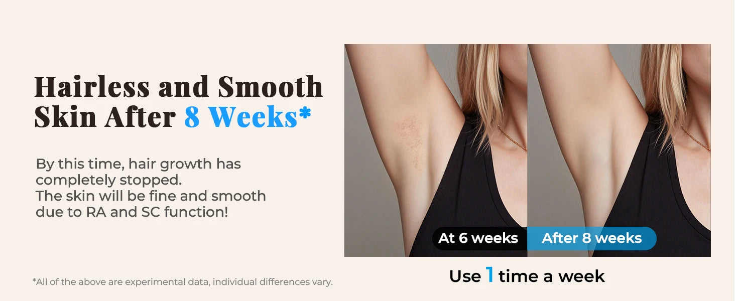 Updated IPL Hair Removal Laser Device 999900+ Flashes 21J Auto/Manual Mode for Men Women Facial Body Bikini  in 4 Weeks Home Use